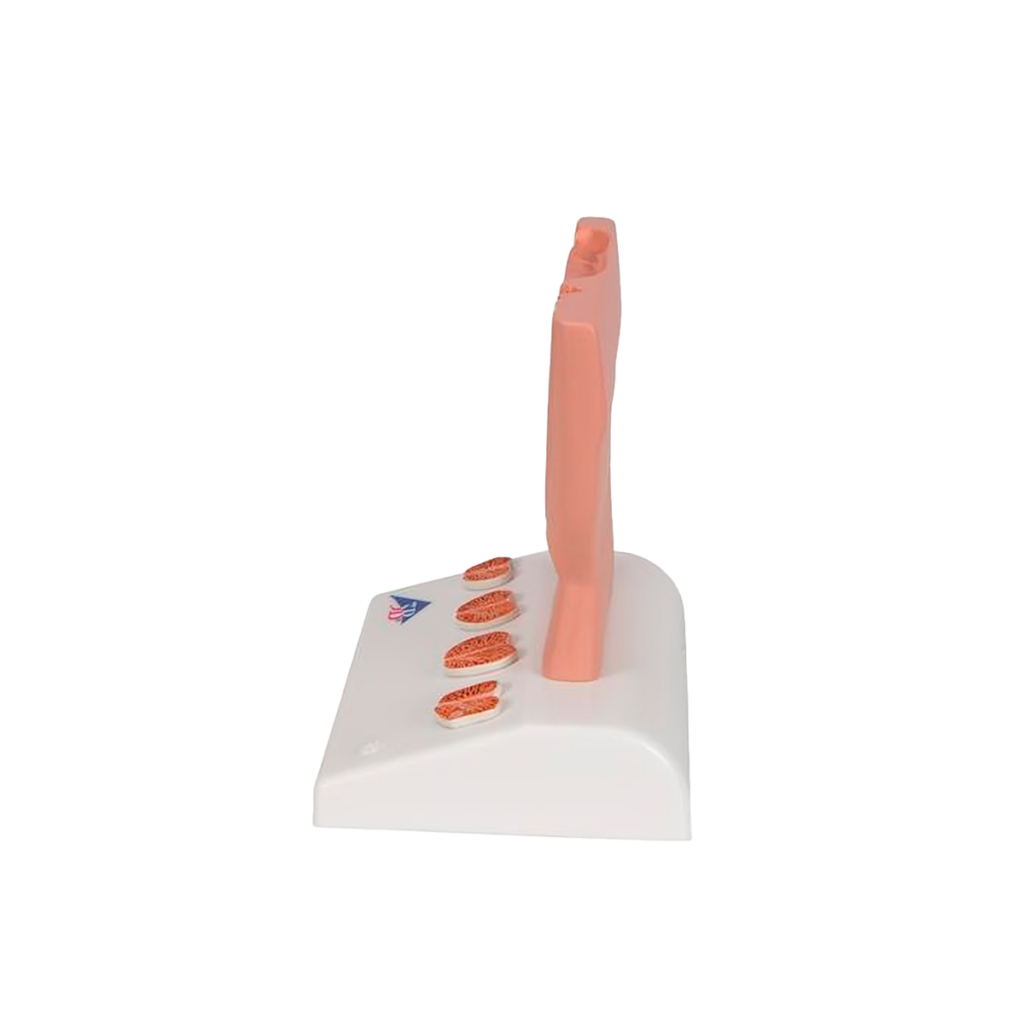 Modelo de la prostata2